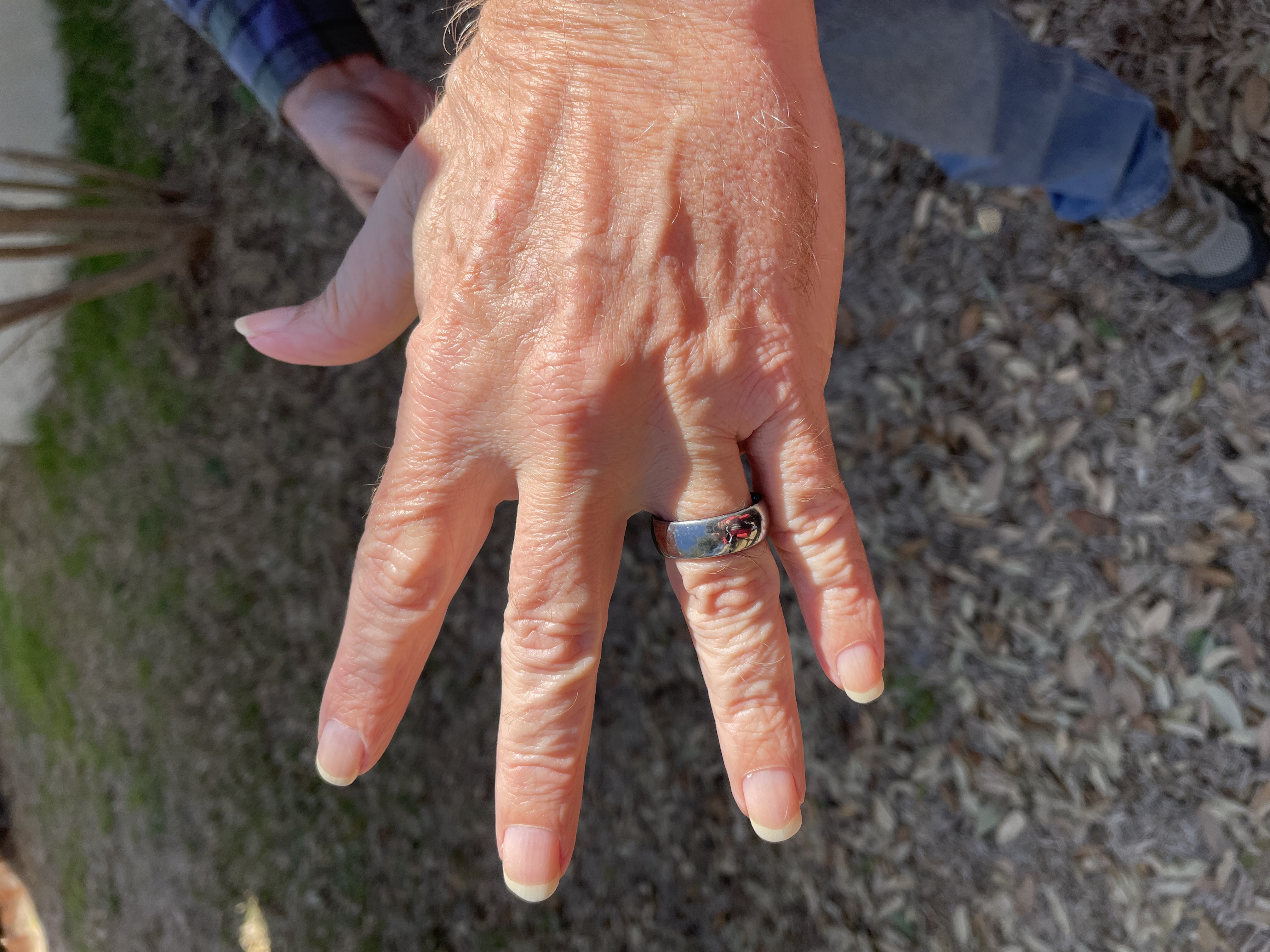 Wedding Ring